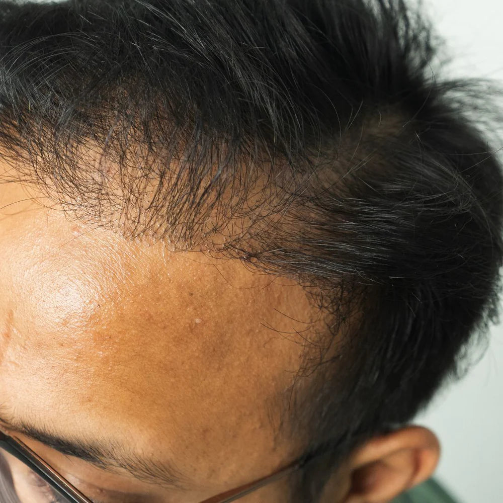 Before